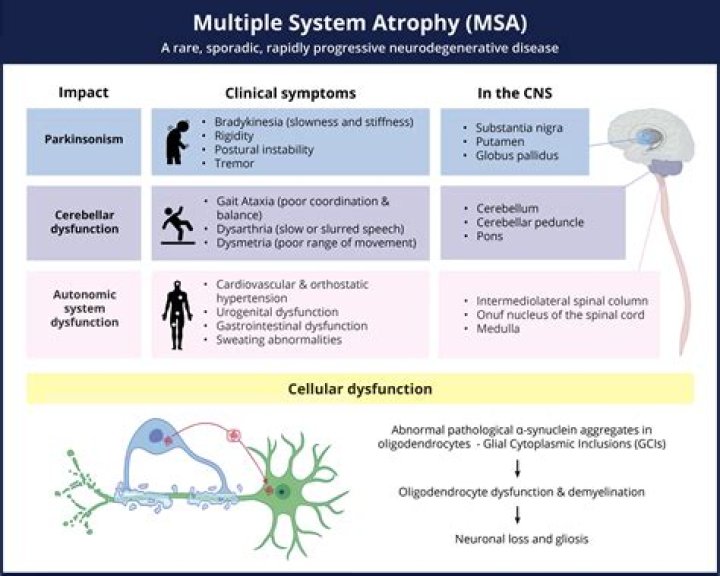 
Gareth O’Callaghan Illness Explained: What Is Multiple System Atrophy Disease? 