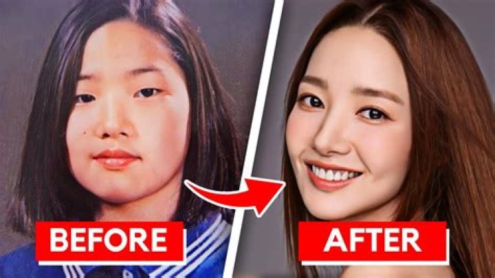 
Has Joo-Young Cha Done Plastic Surgery: The Glory Cast Before And After Photo 