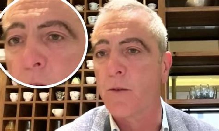 
What Has James Nesbitt Done To His Eyebrows? Has He Tattooed Them 