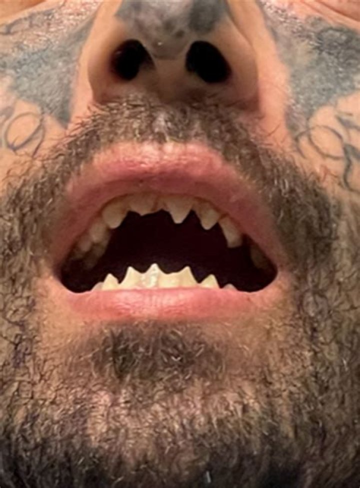 
Who is Michael Barajas? Filed teeth suspect sexually assaulted a woman for three weeks, explained 